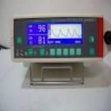 پالس اکسیمتر  NOVAMETRIX 